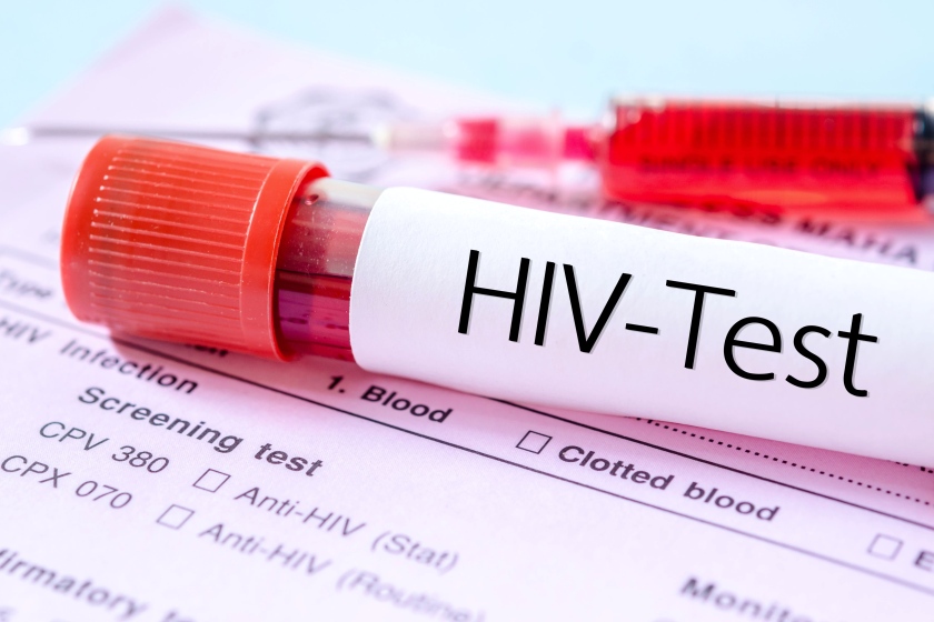 روز بازماندگان HIV
