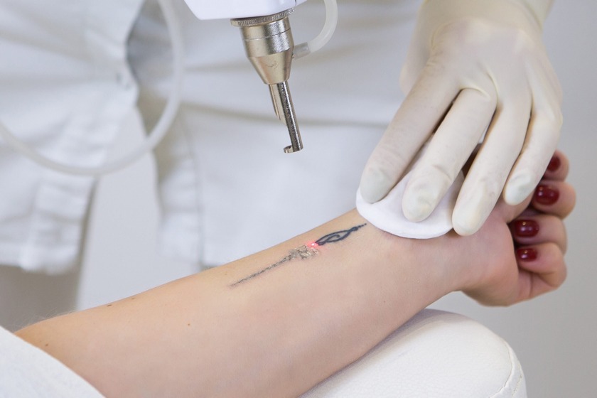 روز پاک کردن خالکوبی. منبع عکس: وبسایت Arvivaesthetics.Com. عکاس: نامشخص